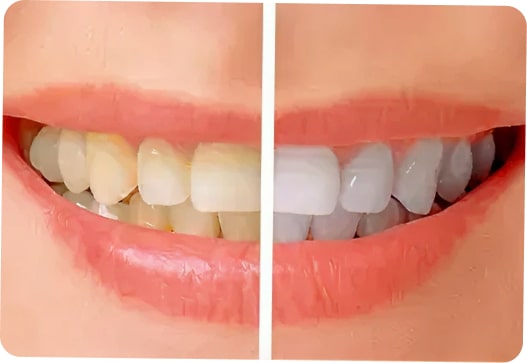 Ageing With <span>a Smile</span>